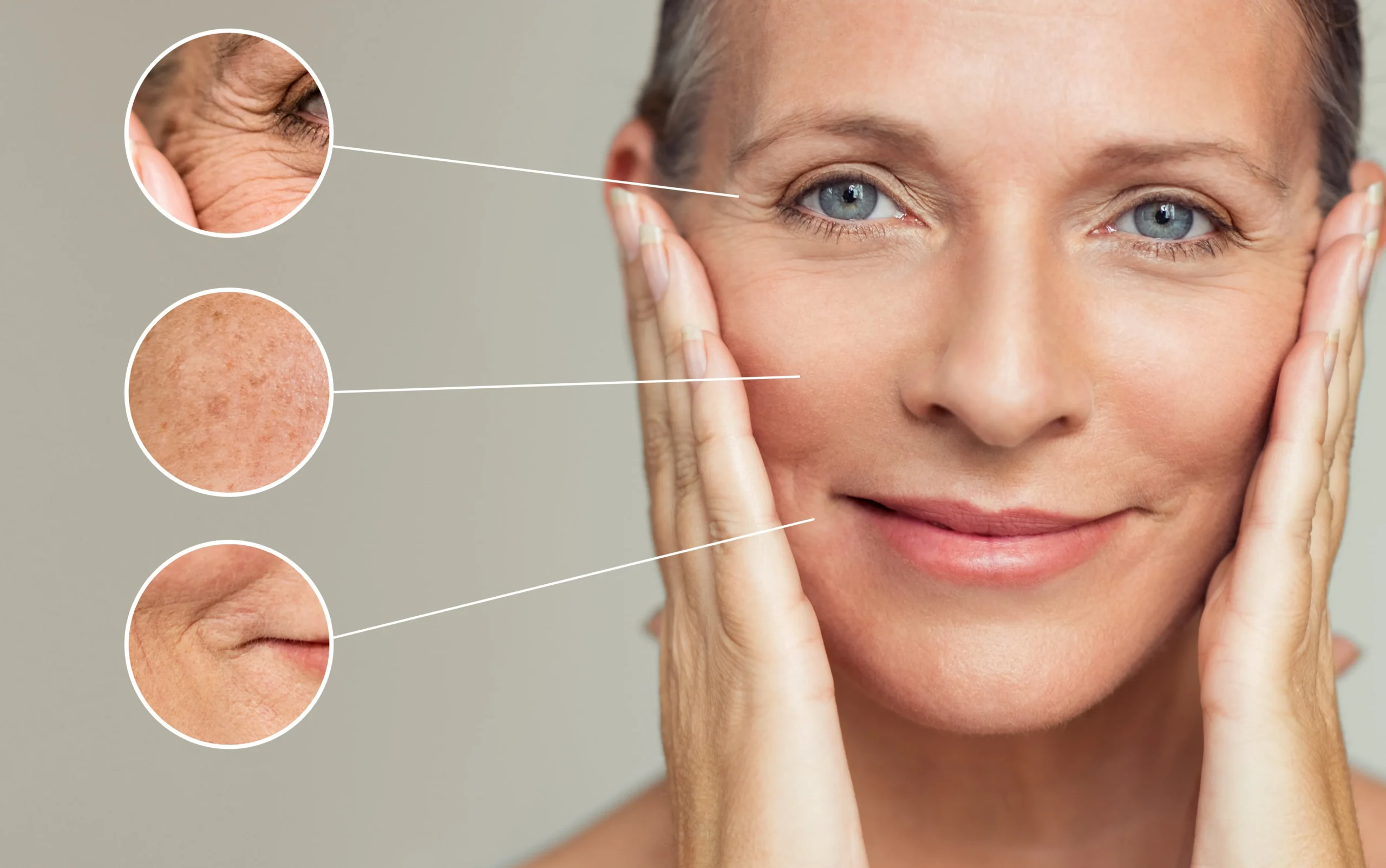 Skin Treatment